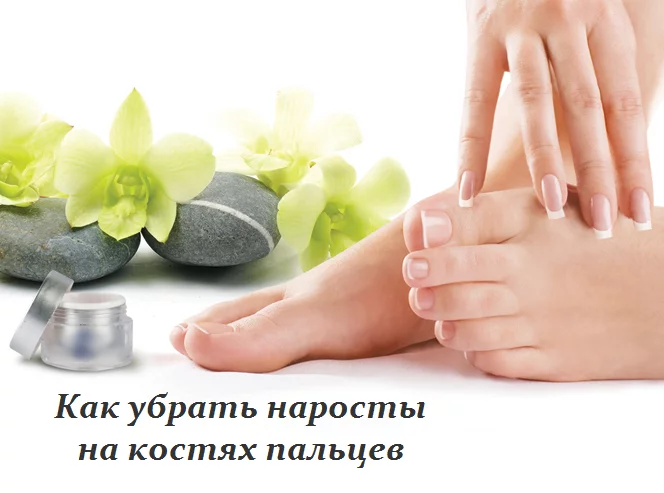 КАК УБРАТЬ НАРОСТЫ НА КОСТЯХ ПАЛЬЦЕВ — РЕЦЕПТ