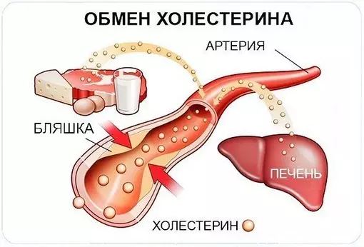 Уровень холестерина можно снизить без проблем