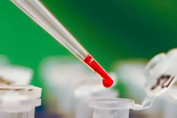 ДЕВЯТЬ ПОКАЗАТЕЛЕЙ КРОВИ, КОТОРЫЕ РАССКАЖУТ О ВАС ВСЁ