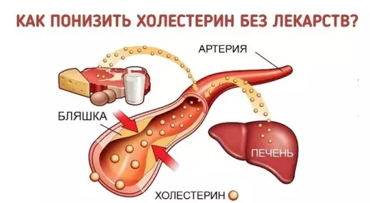 Как легко понизить уровень холестерина БЕЗ лекарств