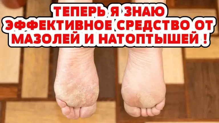 Копеечное средство от мозолей и натоптышей