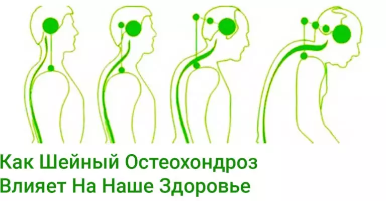 Осторожно. Болит Шея