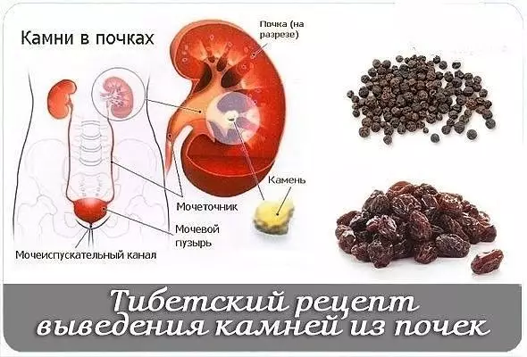 Рецепт выведения камней из почек из далекого Тибета – черный перец