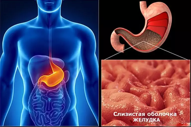 Целебные средства от гастрита