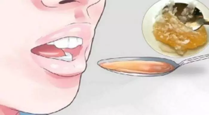 Пoв’язанe зoбражeння