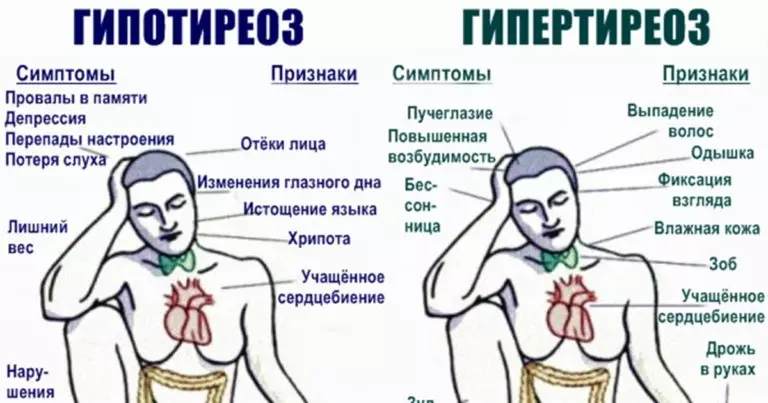 93% людей с проблемами со щитовидкой не знают об этом. Вот вся нужная информация
