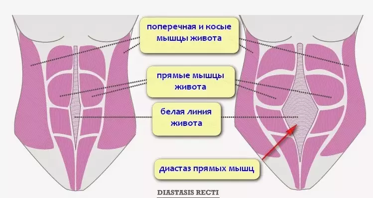 Из-за диостаза вы не сможете похудеть. Все что нужно в этой статье