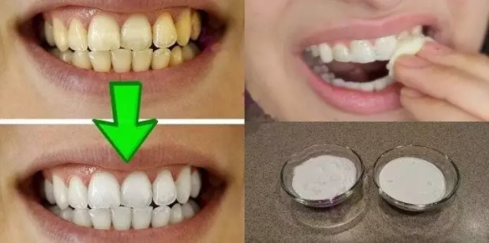 Отбеливание желтых зубов менее чем за 2 минуты