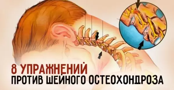 Сделай шаг к здоровью. 8 потрясающих упражнений от шейного остеохондроза