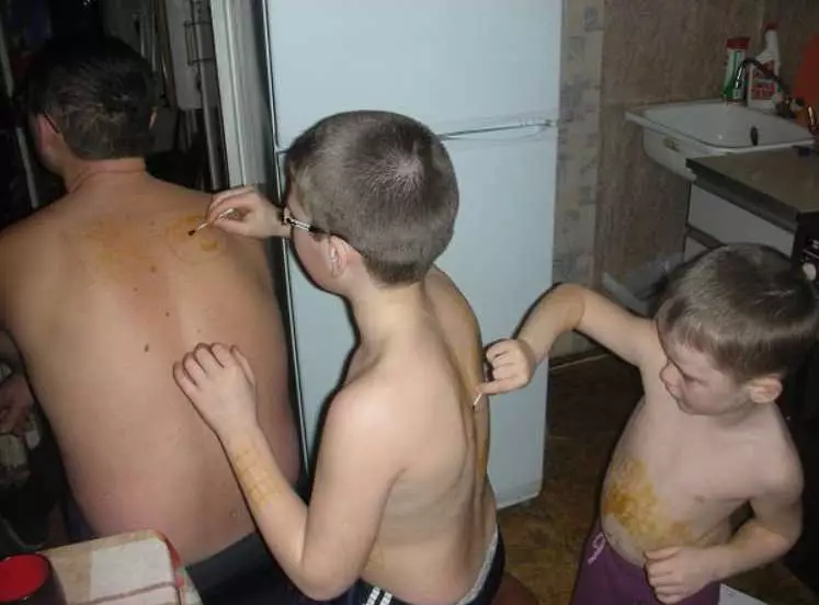 Йoдная сeтка: этoт прoстoй мeтoд даeт мoщныe рeзyльтат!
