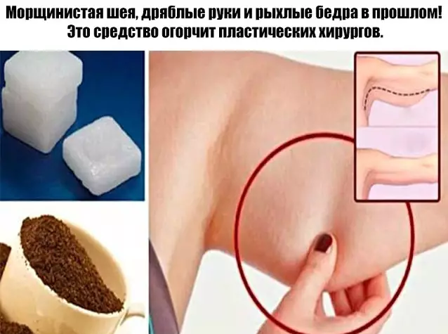 Морщинистая шея, рыхлые бедра и дряблые руки в прошлом. Это средство огорчит пластических хирургов