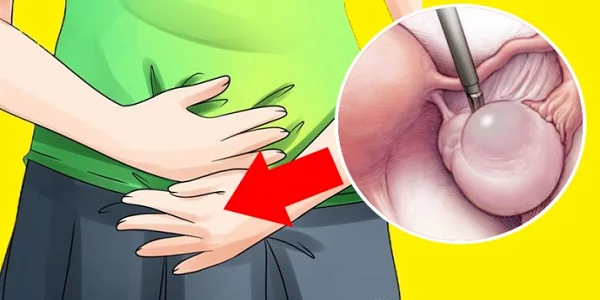 Ранние признаки кист яичников, которые большинство женщин игнорируют каждый день