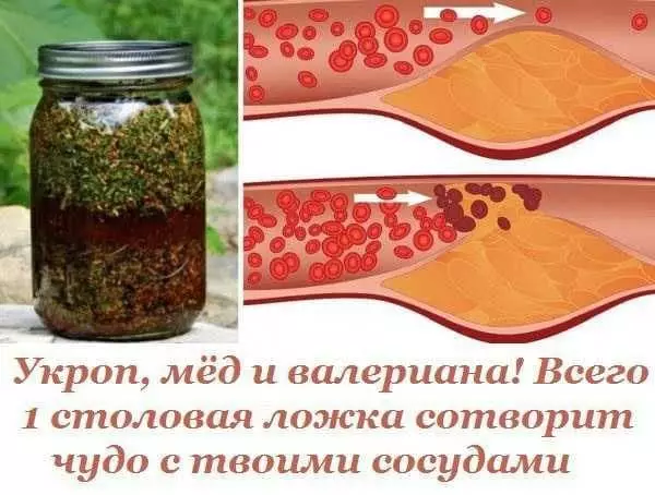 Укроп, мед и валериана. Всего 1 столовая ложка сотворит чудо с твоими сосудами