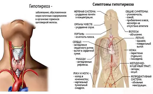 93% людей с проблемами со щитовидкой не знают об этом. Вот вся нужная информация
