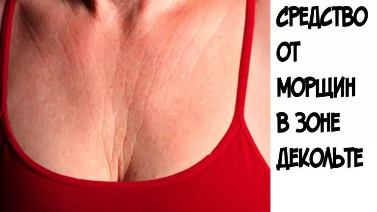 Эти 3 супер средства быстро устранят морщины на груди и шее — вы будете чувствовать себя намного моложе