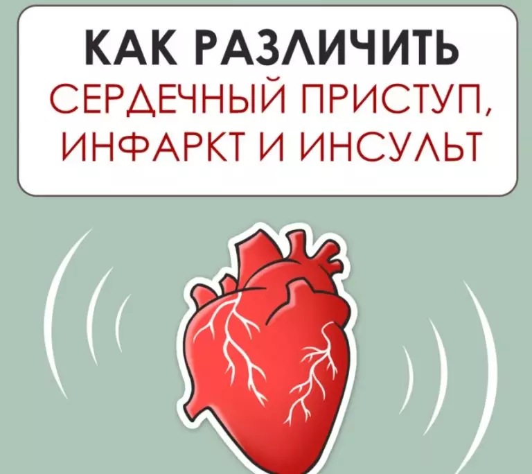 Как различить сердечный приступ, инфаркт и инсульт
