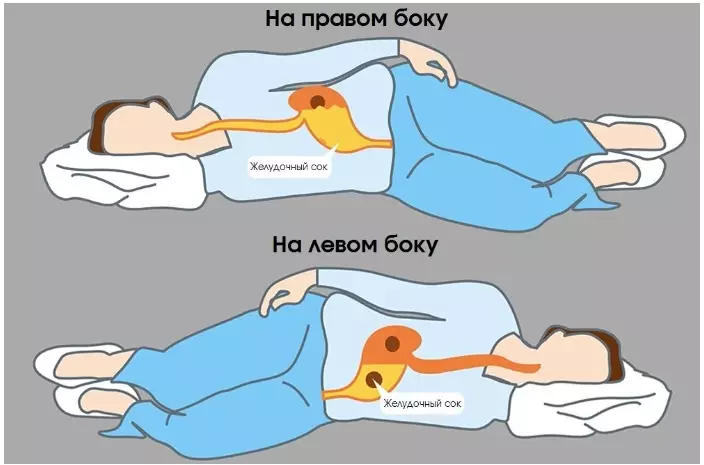 Вряд ли Вы знаете, что происходит, когда вы спите на левом боку