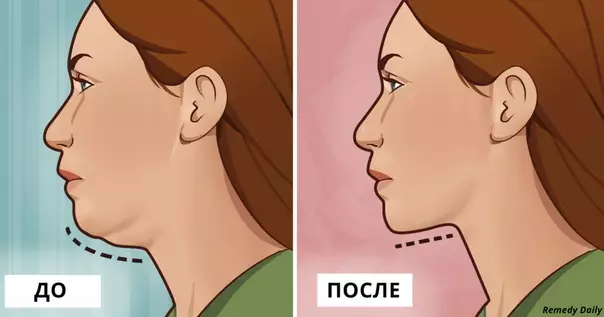 5 простых упражнений от двойного подбородка