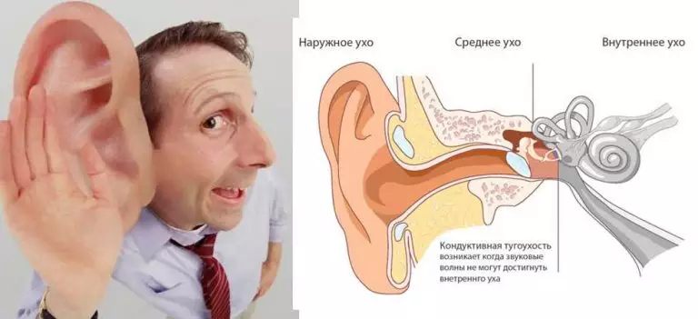 7 рецептов, как вернуть потерянный слух. Лечится даже старческая тугоухость и сильное ухудшение слуха