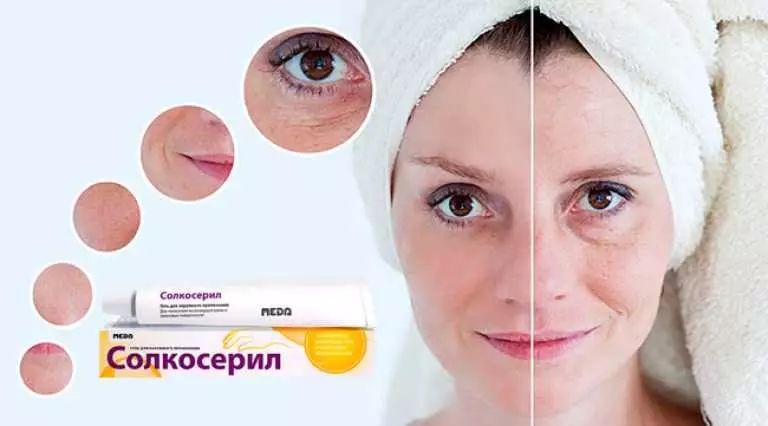 КАК ПРИМЕНЯТЬ СОЛКОСЕРИЛ В ДОМАШНИХ УСЛОВИЯХ