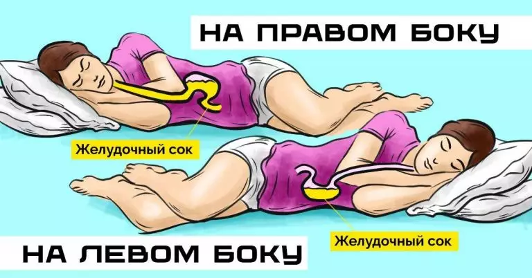 Вы знаете, что происходит, когда вы спите на левом боку. На каком боку рекомендуют спать врачи