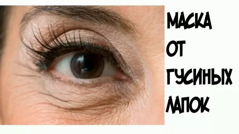 Я избавилась от «гусиных лапок». Делюсь простым и эффективным рецептом с Вами