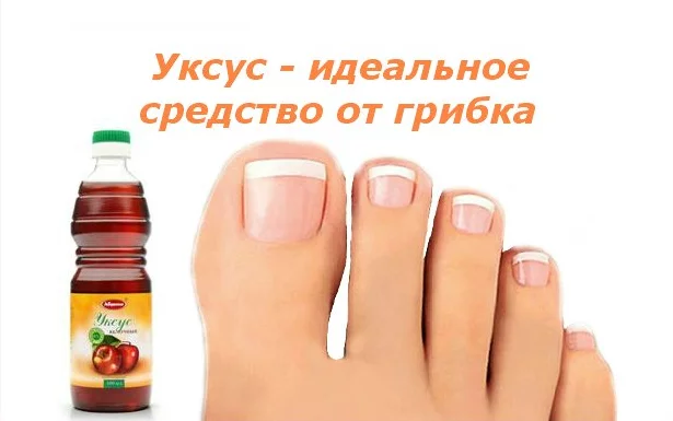 ОТЛИЧНЫЙ РЕЦЕПТ ДЛЯ ЛЕЧЕНИЯ ГРИБКА