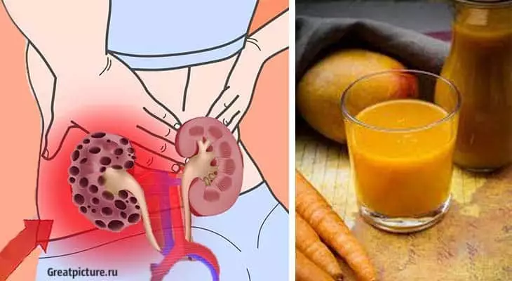 3 рецепта для очищения почек