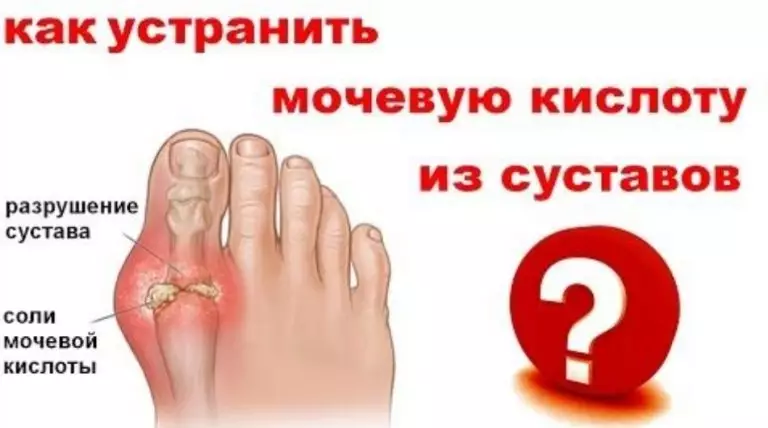 Как снизить уровень мочевой кислоты в организме