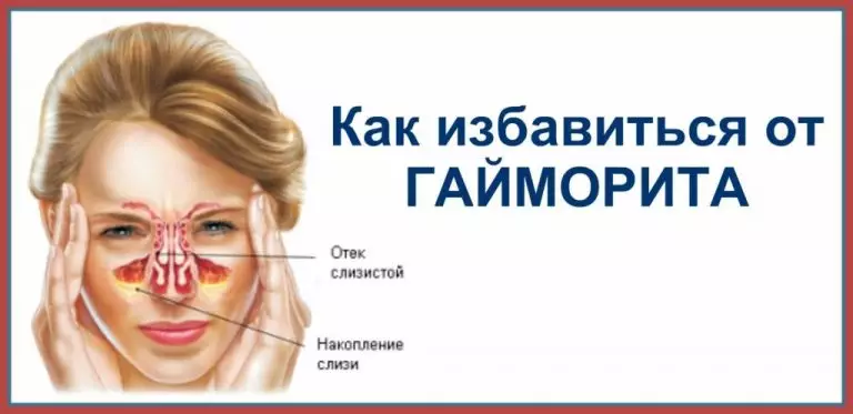 Избавьтесь от гайморита в течение нескольких минут, благодаря ингредиенту, который уже у вас на кухне