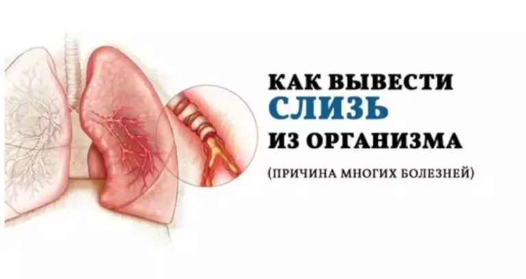 Слизь в организме… Как от нее избавиться