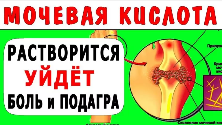 Вот как быстро вывести кристаллы мочевой кислоты из суставов и организма, а также остановить развитие подагры